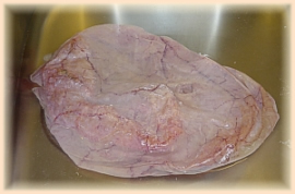 kieker028